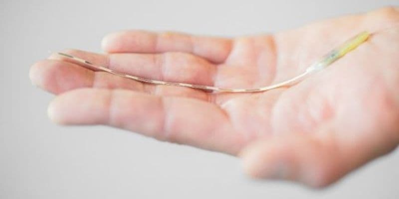 Países Bajos realiza primer implante para tratar la migraña crónica