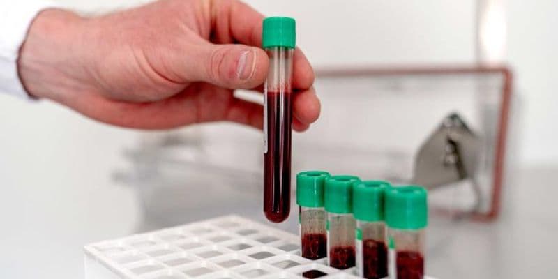 RIVM alerta: todos los ciudadanos en Países Bajos tienen PFAS en la sangre
