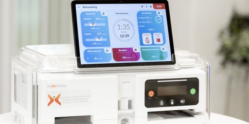 Un riñón artificial portátil que cambiará vidas: Neokidney
