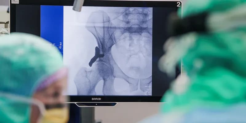 Hospital neerlandés realiza el primer implante de cadera impreso en 3D